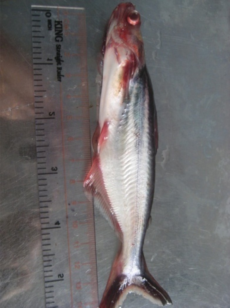 BỆNH GAN XUẤT HUYẾT